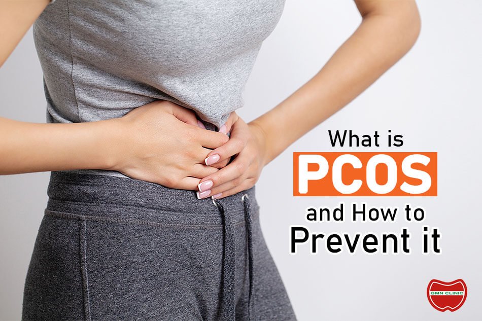 What is PCOS and How to Prevent it